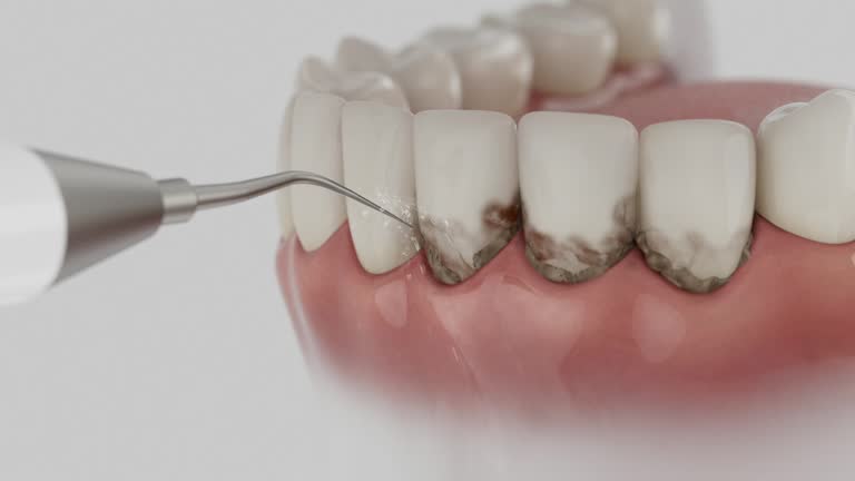 Reliable Dental Implants contractor in Denair, CA by Smile Center Dentistry